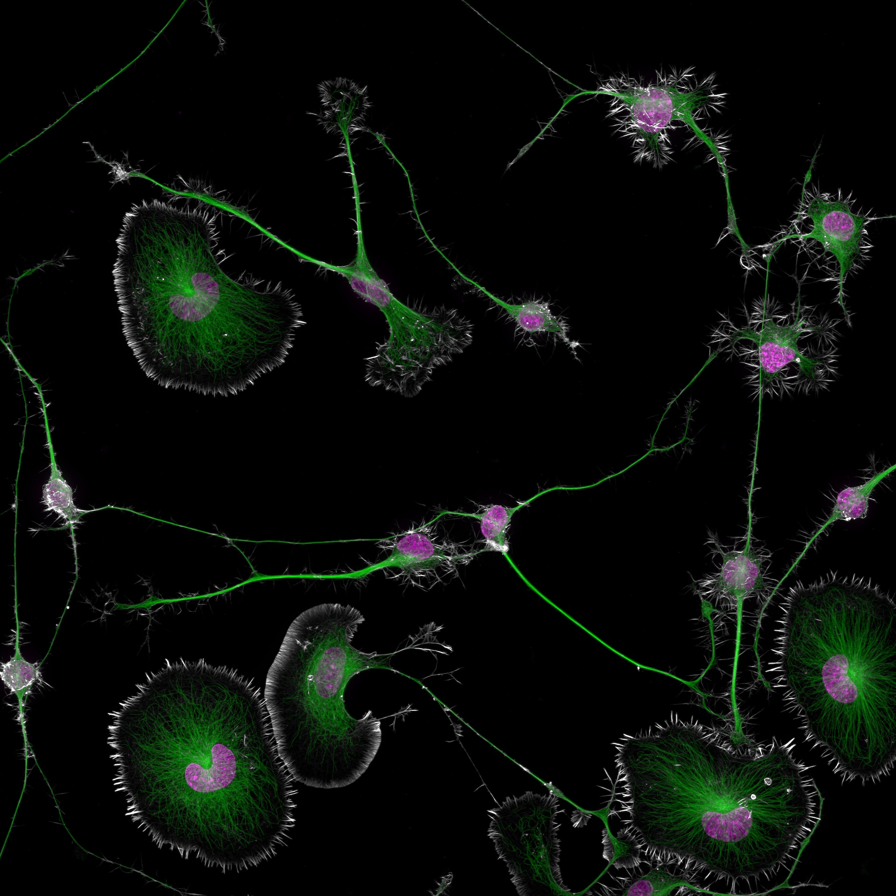 Differentiated mouse brain tumor cells