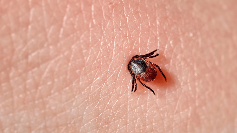 a tick half embedded in human skin