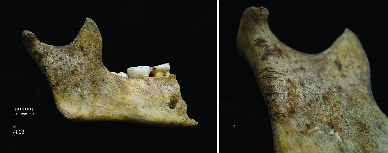 Right hemi-mandible of child aged about 10 years (a) with detail of cutmarks on the ascending ramus (b). Image credit: Schulting et al. Antiquity, December 2024. CREDIT: Schulting et al. Antiquity, December 2024.