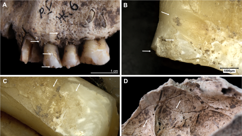 The 5,600-year-old teeth and other bones from this study were found near Kosenivka, Ukraine and are some of the only human remains found that are associated with the Cucuteni-Trypilla culture.