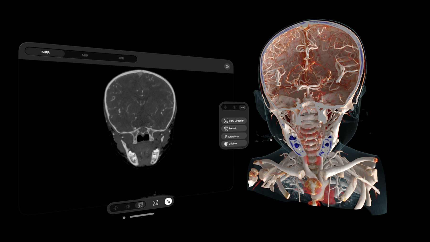 Siemens Healthineers app pov