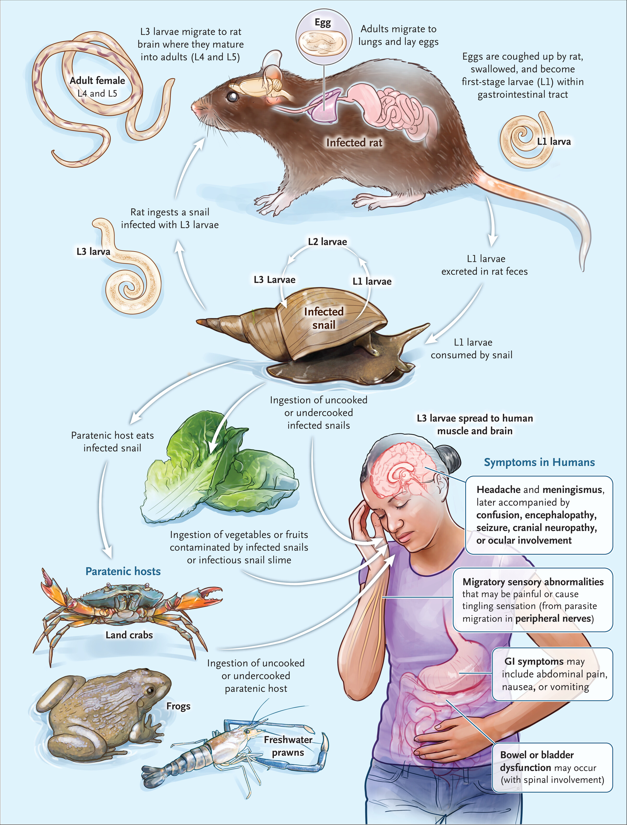 Life cycle illustration of Angiostrongylus cantonensis